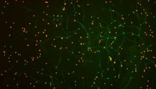 Scientists measured sperm viability with a technique called fluorescent staining. Green dots signify live sperm, while red ones are dead. This image is of mostly dead sperm from a failed queen. 