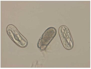 Soybean cyst nematode eggs