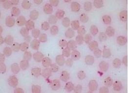 Figure 1: Anaplama marginale organisms (small purple dots) in the red blood cells (larger pink circles)
