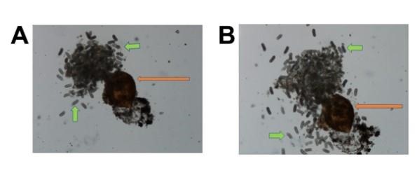 Figure 3. Two views of a single cyst that holds 200 to 300 eggs. “A” demonstrates a mass of eggs coming from the cyst after it was punctured. “B” shows the same cyst with more eggs released. Orange arrows show the cyst, green arrows show single eggs