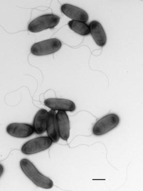 Pseudomonas uvaldensis sp. nov. bacterium magnified by electron microscope.  