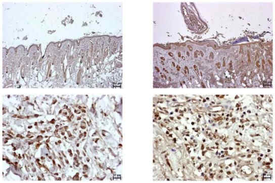 Immunohistochemical staining of PD-L1 in tick-nonattached